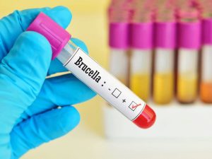 What Are the Symptoms of a Deadly Disease? – EP Fitness Trainer